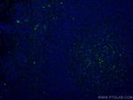 CD70 Antibody in Immunohistochemistry (Paraffin) (IHC (P))