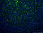 CD70 Antibody in Immunohistochemistry (Paraffin) (IHC (P))