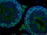 EED Antibody in Immunohistochemistry (Paraffin) (IHC (P))