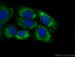 citrate synthase Antibody in Immunocytochemistry (ICC/IF)