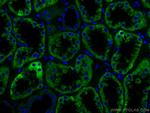 AIF Antibody in Immunohistochemistry (Paraffin) (IHC (P))