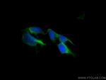 EIF4A2 Antibody in Immunocytochemistry (ICC/IF)