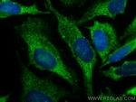 FXR1 Antibody in Immunocytochemistry (ICC/IF)