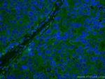 DAPK1 Antibody in Immunohistochemistry (Paraffin) (IHC (P))