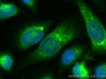 HSP47 Antibody in Immunocytochemistry (ICC/IF)