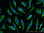 KBTBD2 Antibody in Immunocytochemistry (ICC/IF)