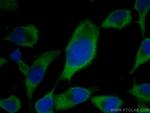 AlaRS Antibody in Immunocytochemistry (ICC/IF)