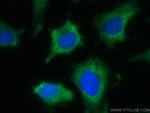 SCAMP3 Antibody in Immunocytochemistry (ICC/IF)