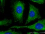 LARS Antibody in Immunocytochemistry (ICC/IF)