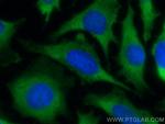 PAIP1 Antibody in Immunocytochemistry (ICC/IF)