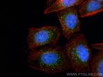 EEA1 Antibody in Immunocytochemistry (ICC/IF)