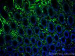 Collagen Type III Antibody in Immunohistochemistry (Paraffin) (IHC (P))