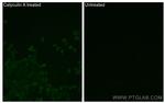 Phospho-STK11 (Thr189) Antibody in Immunocytochemistry (ICC/IF)