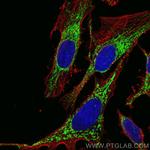 C1QBP Antibody in Immunocytochemistry (ICC/IF)