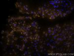 BCL2 Antibody in Immunohistochemistry (PFA fixed) (IHC (PFA))