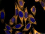 EIF2A/CDA02 Antibody in Immunocytochemistry (ICC/IF)