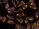 VPS53 Antibody in Immunocytochemistry (ICC/IF)