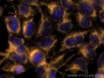 MTHFD1 Antibody in Immunocytochemistry (ICC/IF)