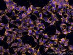 MTHFD1 Antibody in Immunocytochemistry (ICC/IF)