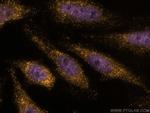 cyclin B1 Antibody in Immunocytochemistry (ICC/IF)