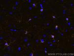 IBA1 Antibody in Immunohistochemistry (PFA fixed) (IHC (PFA))