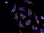 PEX14 Antibody in Immunocytochemistry (ICC/IF)