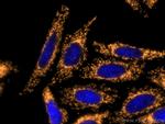 TOM20 Antibody in Immunocytochemistry (ICC/IF)