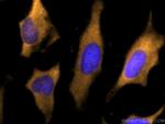 LDHB Antibody in Immunocytochemistry (ICC/IF)