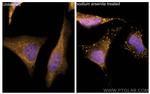 G3BP2 Antibody in Immunocytochemistry (ICC/IF)