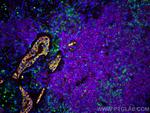 pan-keratin Antibody in Immunohistochemistry (Paraffin) (IHC (P))