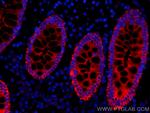 pan-keratin Antibody in Immunohistochemistry (Paraffin) (IHC (P))