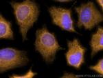 NDRG1 Antibody in Immunocytochemistry (ICC/IF)