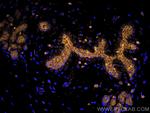 Cytokeratin 19 Antibody in Immunohistochemistry (Paraffin) (IHC (P))