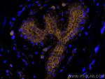 Cytokeratin 19 Antibody in Immunohistochemistry (Paraffin) (IHC (P))