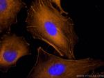 Beta Actin Antibody in Immunocytochemistry (ICC/IF)