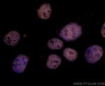 TBP Antibody in Immunocytochemistry (ICC/IF)