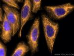 Cytokeratin 18 Antibody in Immunocytochemistry (ICC/IF)