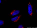 TGN46 Antibody in Immunocytochemistry (ICC/IF)