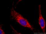 PARK2/Parkin Antibody in Immunocytochemistry (ICC/IF)