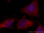 CBS Antibody in Immunocytochemistry (ICC/IF)