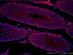 C9orf72 Antibody in Immunohistochemistry (PFA fixed) (IHC (PFA))