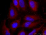 FSHR Antibody in Immunocytochemistry (ICC/IF)