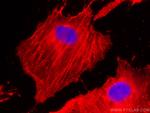 beta Actin Antibody in Immunocytochemistry (ICC/IF)