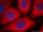 beta Actin Antibody in Immunocytochemistry (ICC/IF)