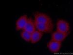 Stanniocalcin 2 Antibody in Immunocytochemistry (ICC/IF)