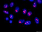 B23/NPM1 Antibody in Immunocytochemistry (ICC/IF)