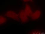 BRD8 Antibody in Immunocytochemistry (ICC/IF)