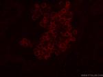 CD206 Antibody in Immunohistochemistry (PFA fixed) (IHC (PFA))