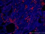 CD206 Antibody in Immunohistochemistry (PFA fixed) (IHC (PFA))