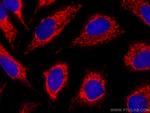 ALDH1A1 Antibody in Immunocytochemistry (ICC/IF)